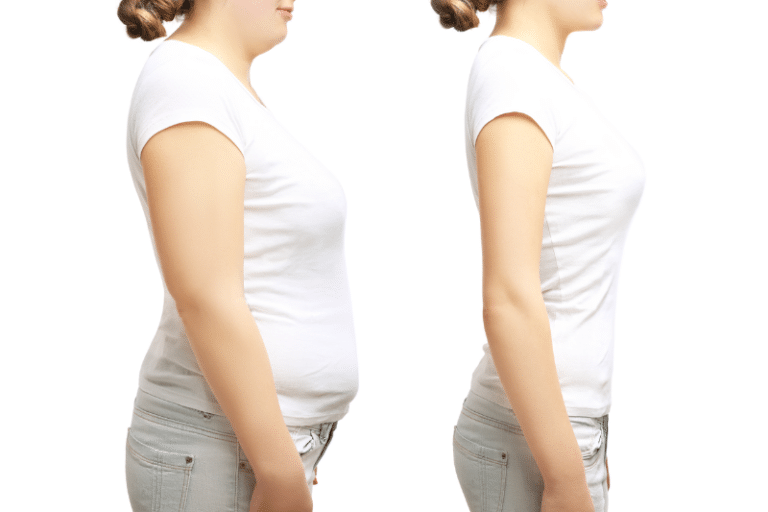 Weight Loss and Aesthetic Procedures