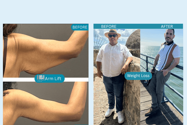 Combining Cosmetic Procedures and Weight Loss Treatments