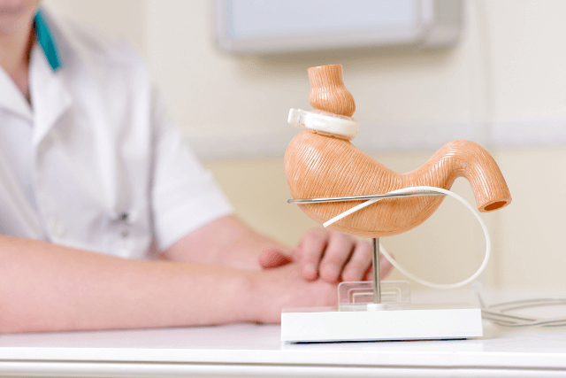 Bariatric Surgery Requirements