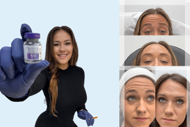 Top Botox Trends in Tampa