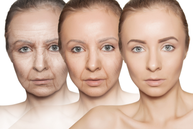 a beefore and after photo of a woman showing the power of Anti-Aging procedures