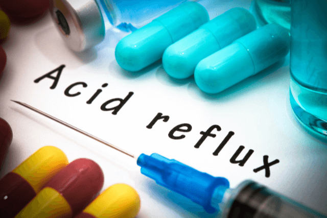 Acid Reflux Treatment Clinic in Tampa Florida